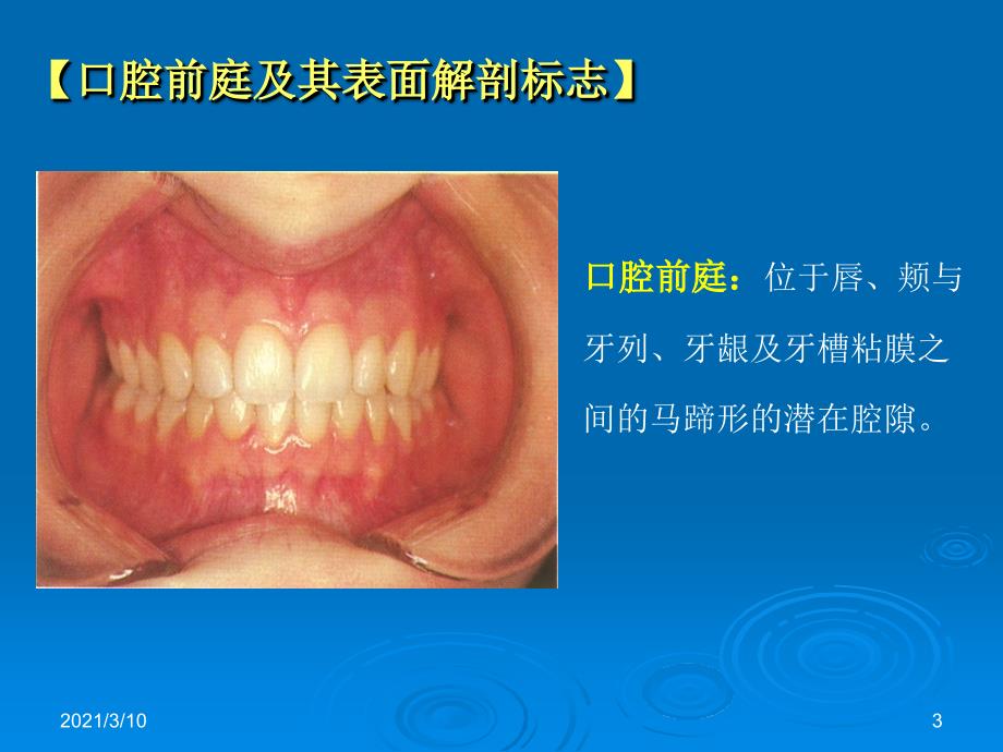 vhpAAA口腔局部解剖_第3页