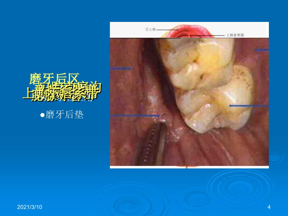 vhpAAA口腔局部解剖_第4页