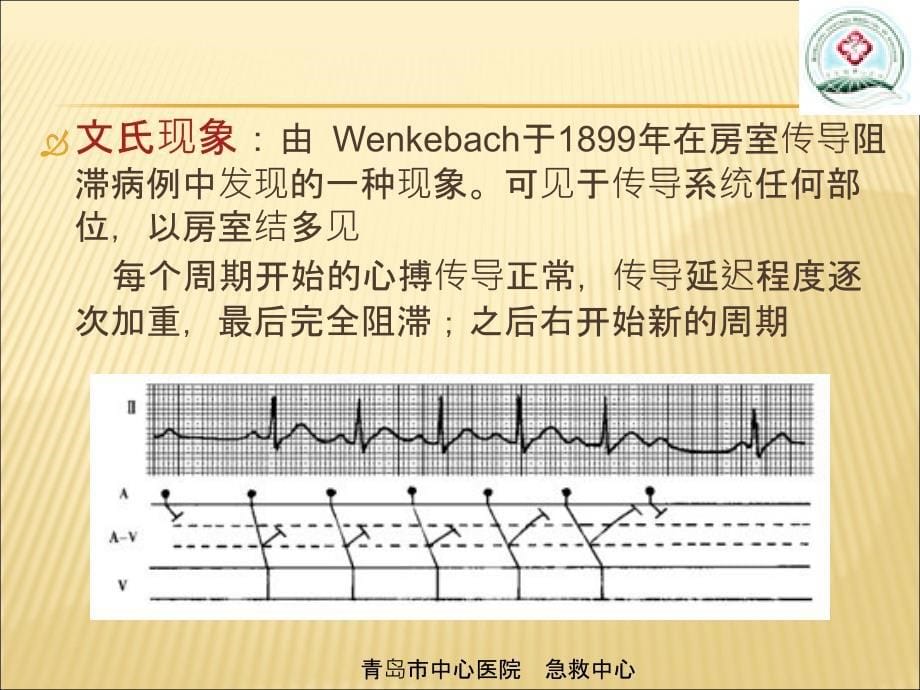 室性心动过速的心电图鉴别PPT精选文档_第5页