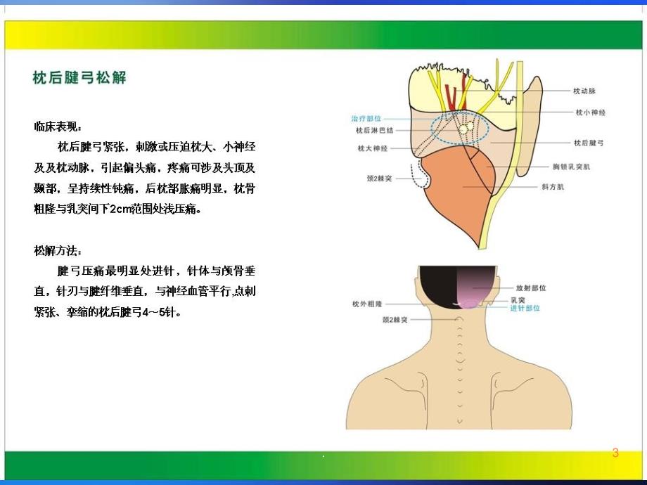 中华针刀治疗图解ppt课件_第3页