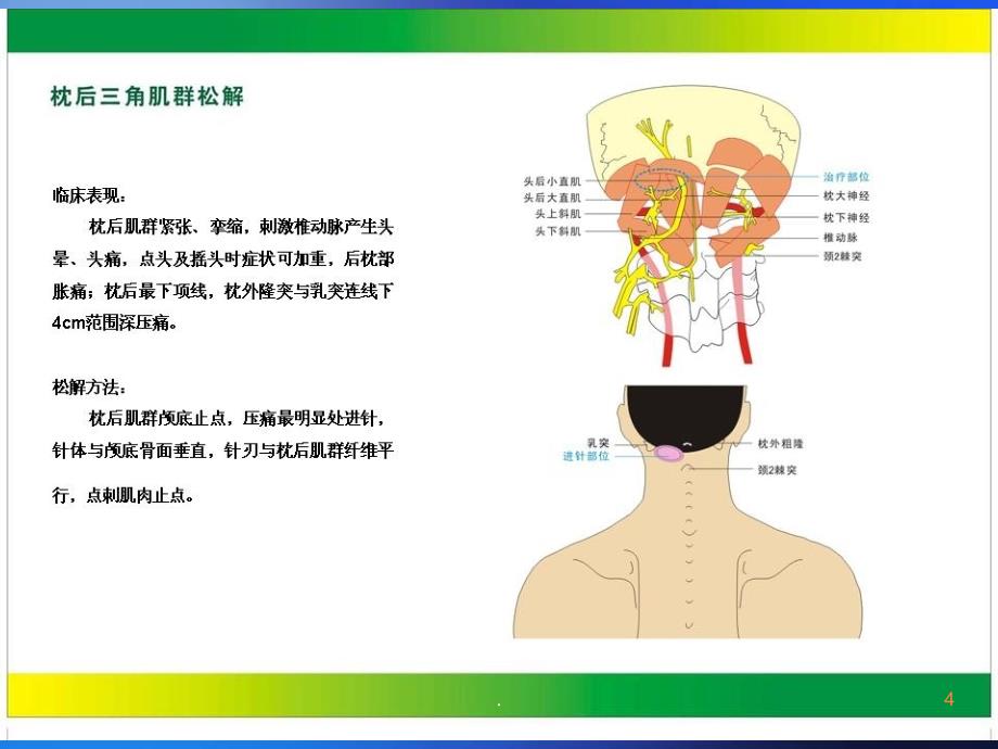 中华针刀治疗图解ppt课件_第4页