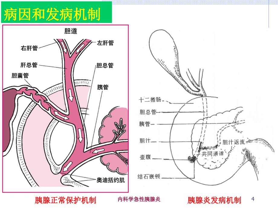 内科学急性胰腺炎培训课件_第4页