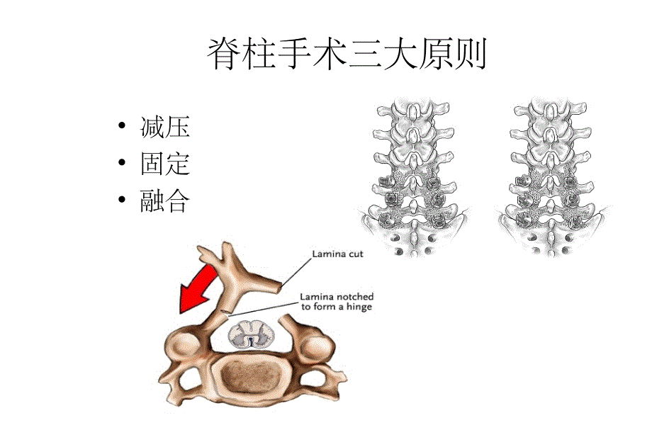 脊柱内固定原理_第4页