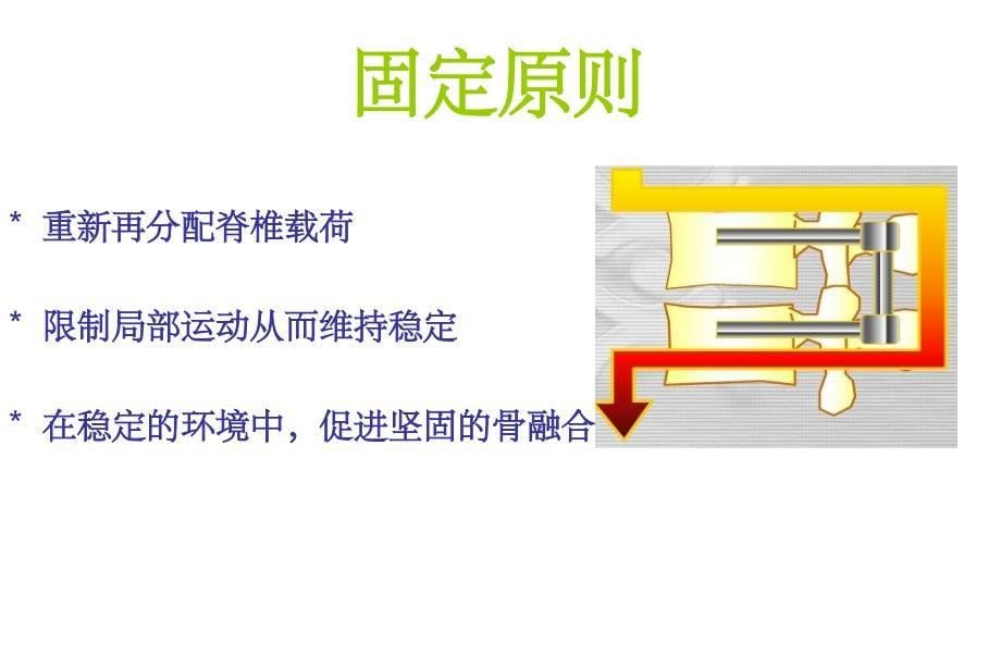 脊柱内固定原理_第5页