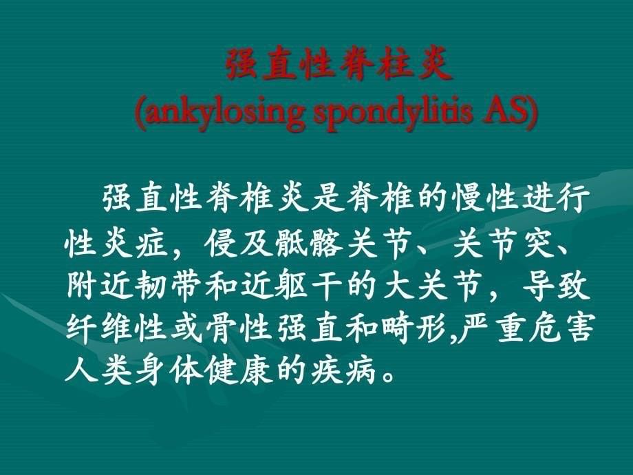 强直性脊柱炎PPT课件_第5页