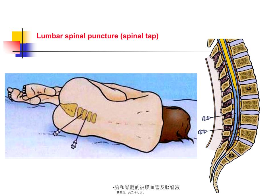 脑和脊髓的被膜血管及脑脊液课件_第4页