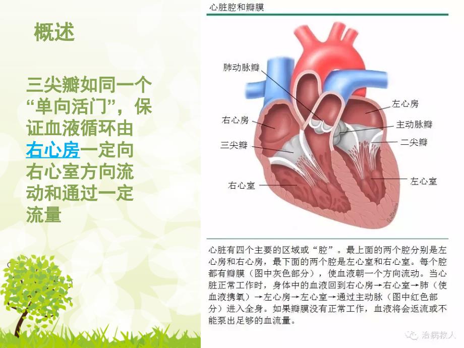 胸腔镜三尖瓣置换术后护理查房.ppt_第3页