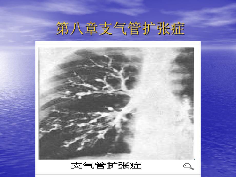 第八讲支气管扩张症课件_第1页