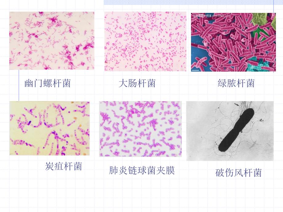 安全用药第4章抗感染药_第4页