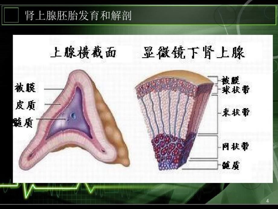 肾上腺肿瘤围手术期护理课件_第5页