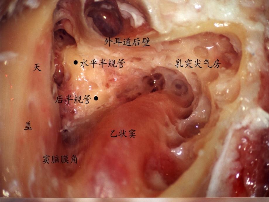 耳的应用解剖及生理学课件_第2页