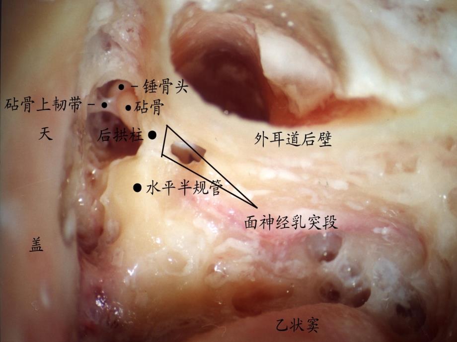 耳的应用解剖及生理学课件_第3页