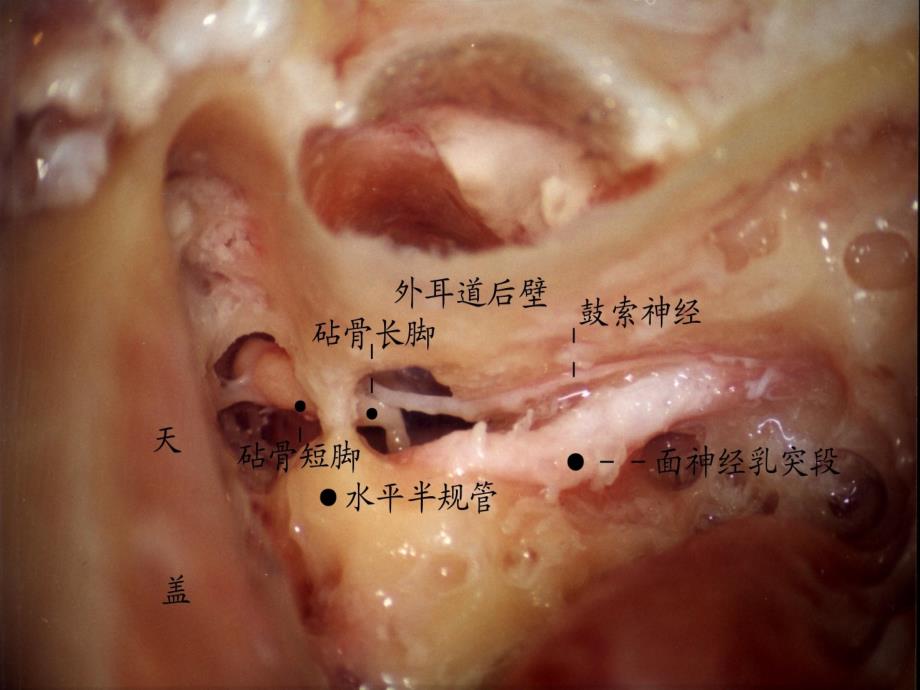 耳的应用解剖及生理学课件_第4页