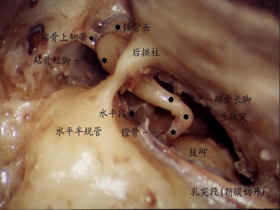 耳的应用解剖及生理学课件_第5页