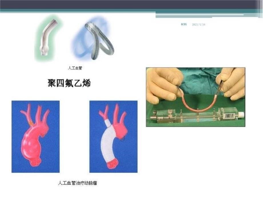 最新大学材料科学与工程经典课件第九章生物医用高分子材料PPT课件_第5页