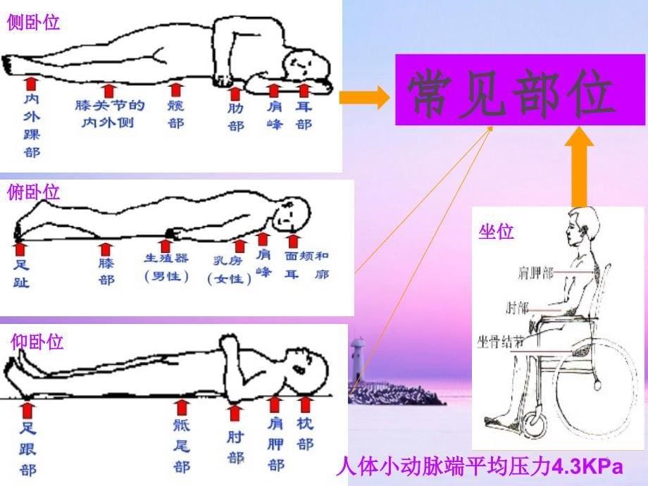 压疮的预防及护理学习课件_第5页