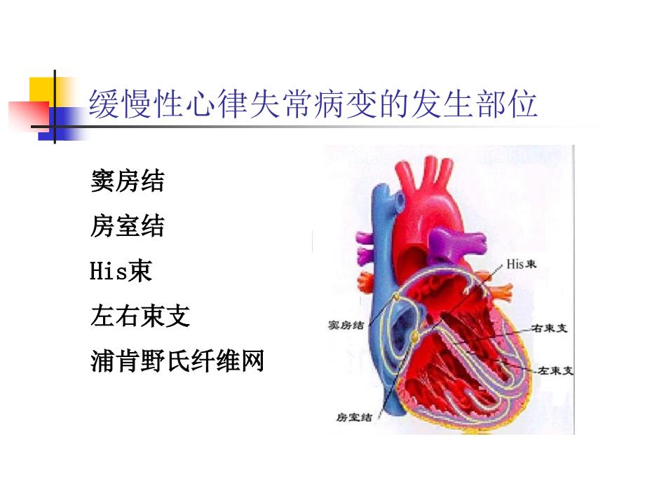 缓慢性心律失常的诊断和治疗_第3页