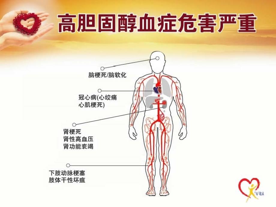 最新：高血脂的治疗ppt课件文档资料_第1页