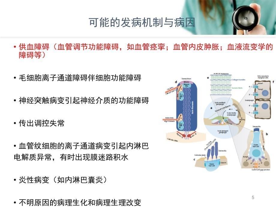 推荐精选突发性耳聋的诊疗进展及指南解读_第5页