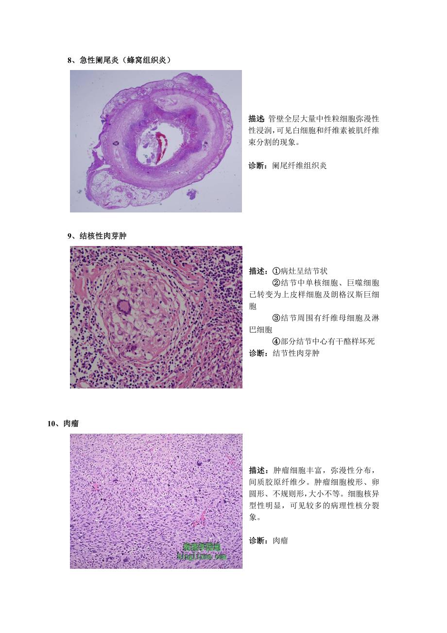 病理切片整理_第3页