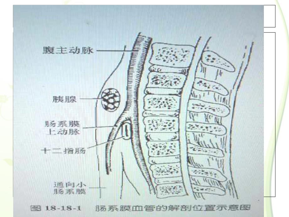 肠系膜上动脉综合征.ppt_第4页