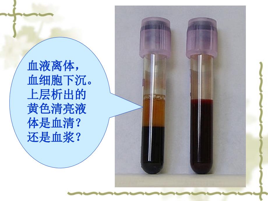 项目凝血因子检查PPT课件_第4页