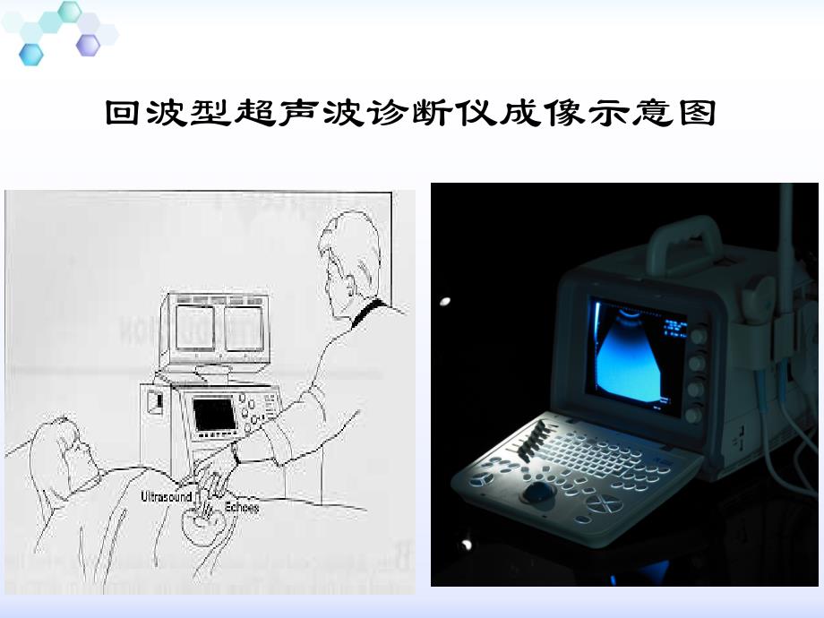 超声基础及临床应用_第2页