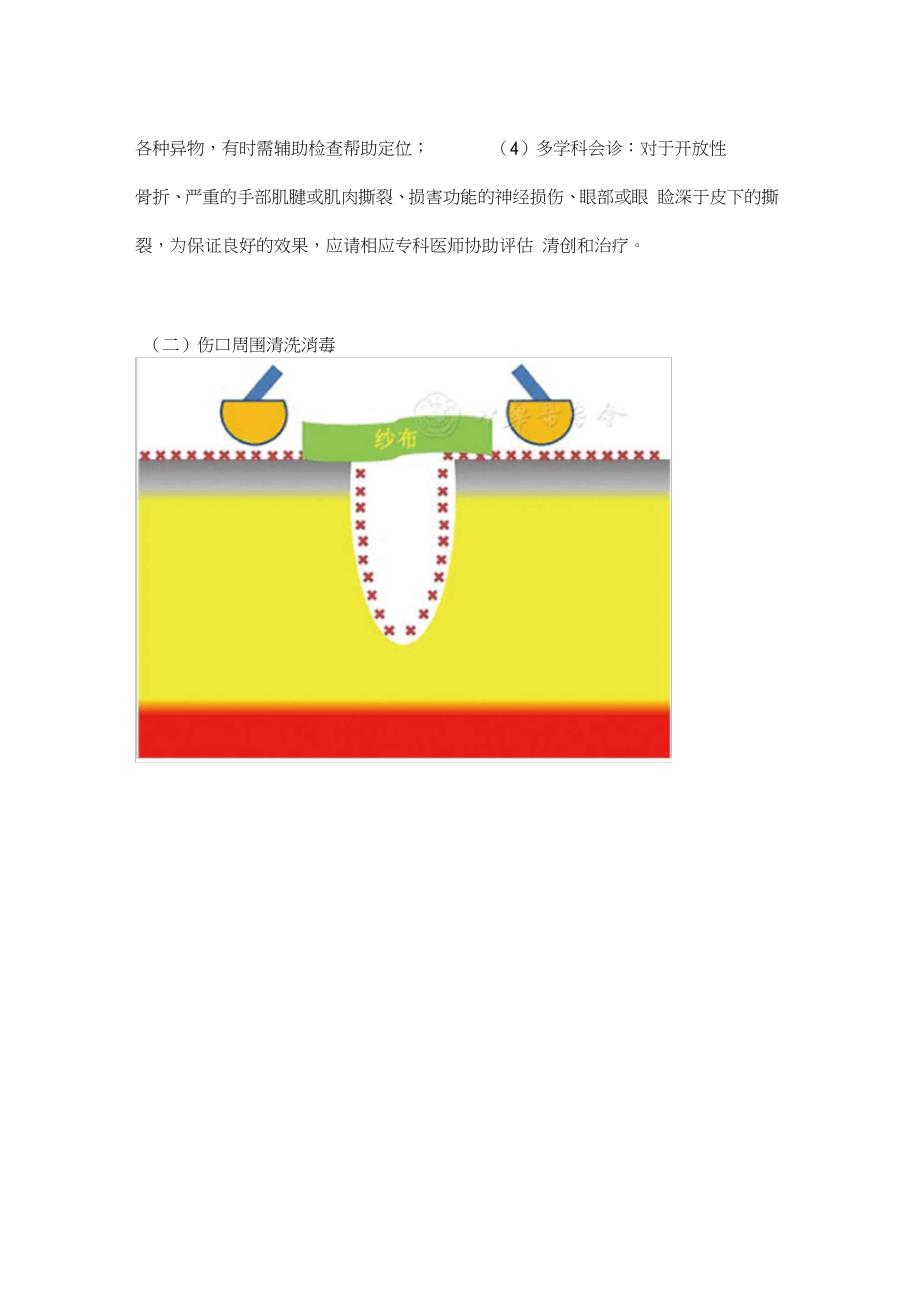 2021急诊开放性伤口清创缝合术专家共识（完整版）_第4页