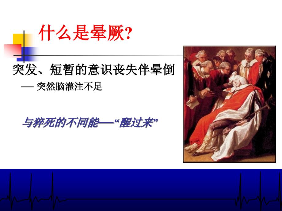 晕厥病的鉴别诊断和治疗原则修改后.ppt_第3页