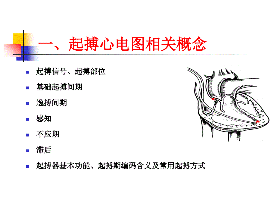 《起搏心电图基础》PPT课件_第2页