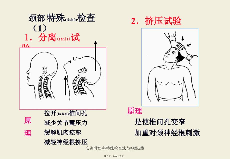 实训骨伤科特殊检查法与神经x线课件_第2页