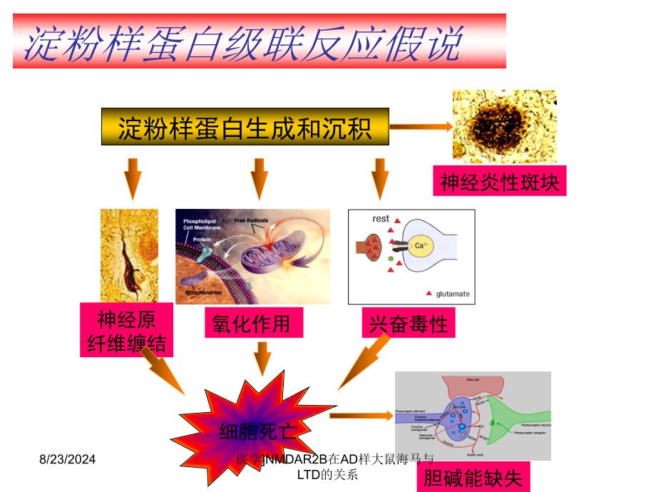 医学NMDAR2B在AD样大鼠海马与LTD的关系课件_第4页