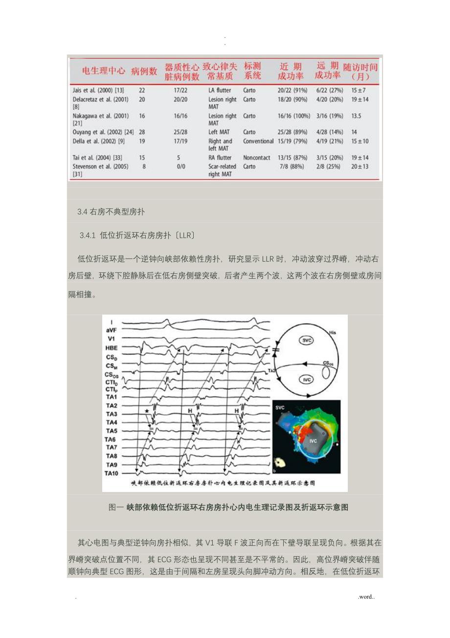 不典型房扑的分类、诊断及消融_第4页