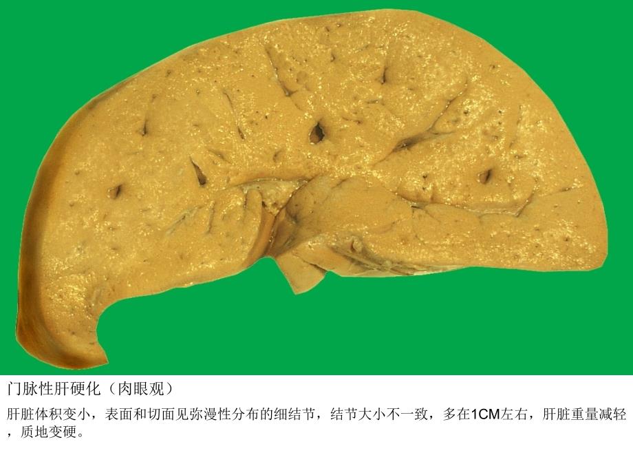 病理实验图文并茂X考试图片_第4页