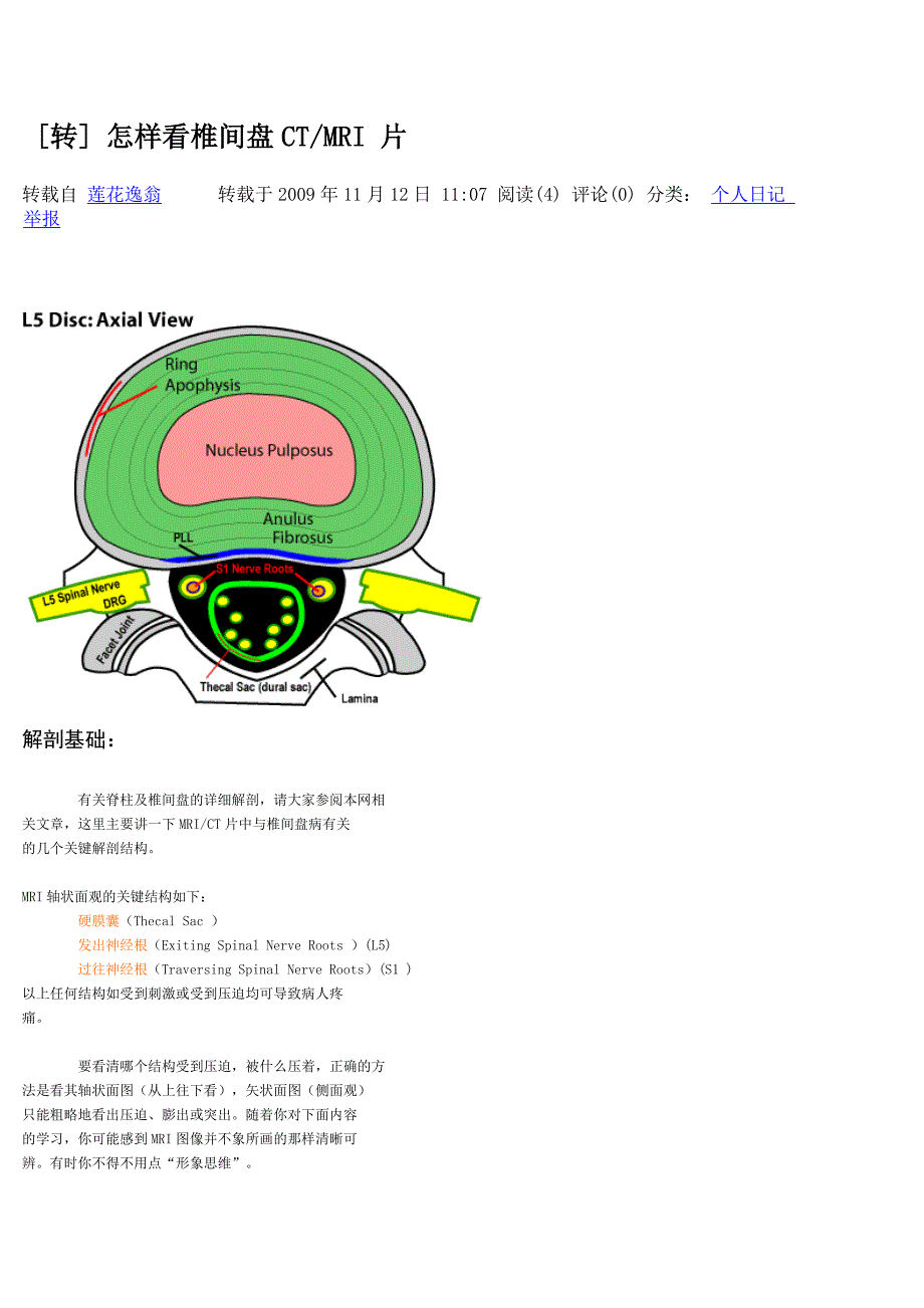 怎样看椎间盘CT_MRI_片.doc_第1页