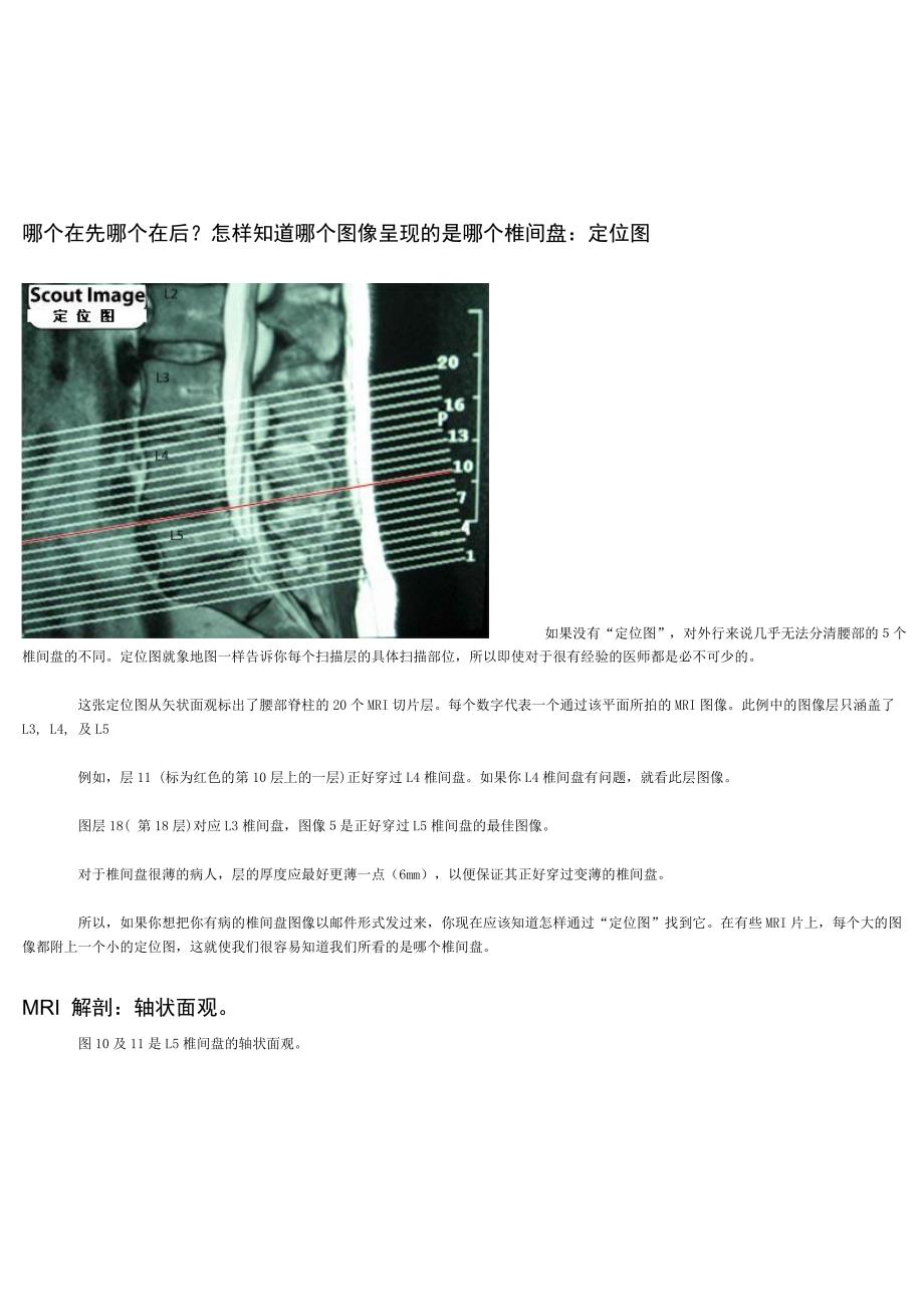 怎样看椎间盘CT_MRI_片.doc_第2页