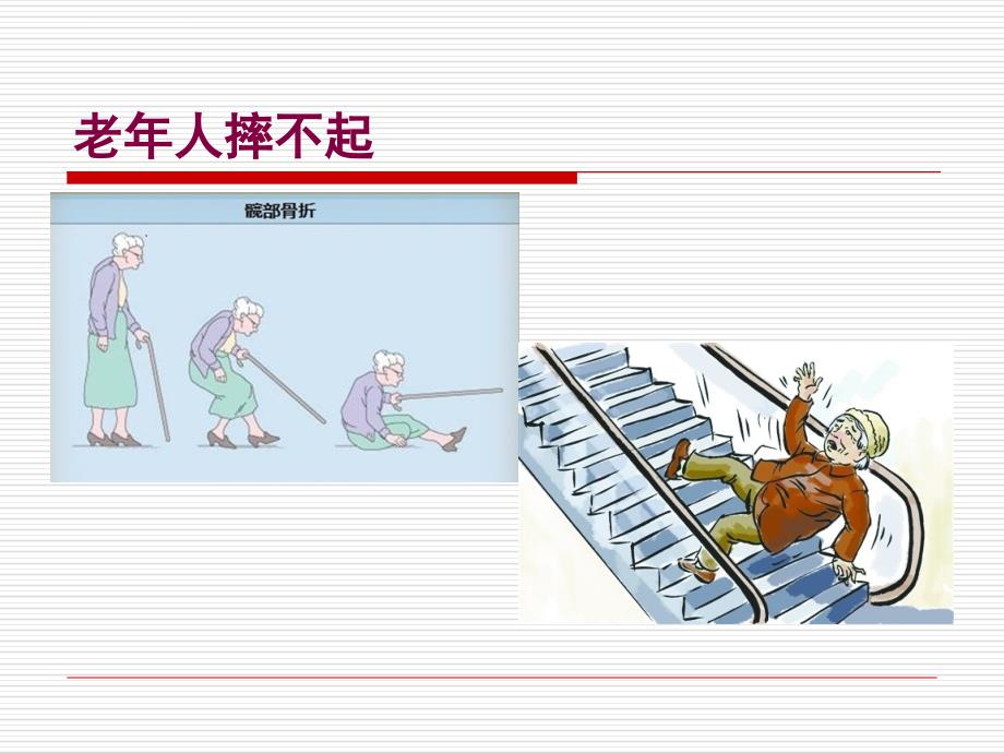 老年髋部骨折ppt课件_第2页