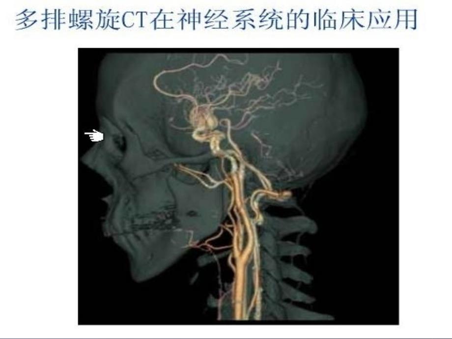 《神经内科交流学习》PPT课件_第1页