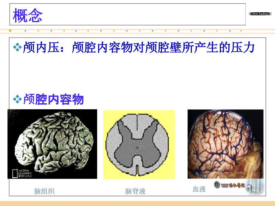 颅内高压的护理PPT课件_第2页