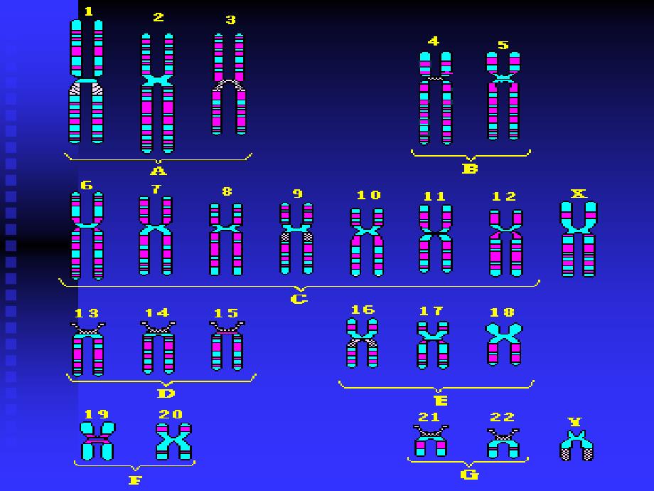 人染色体与染色体病_第4页