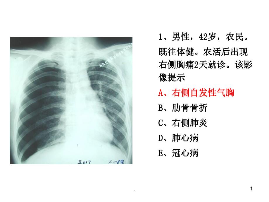 住院医师规陪出科考试辅助检查4PPT精选文档_第1页