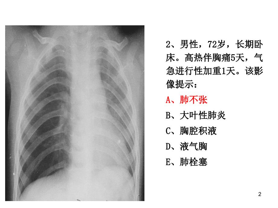 住院医师规陪出科考试辅助检查4PPT精选文档_第2页