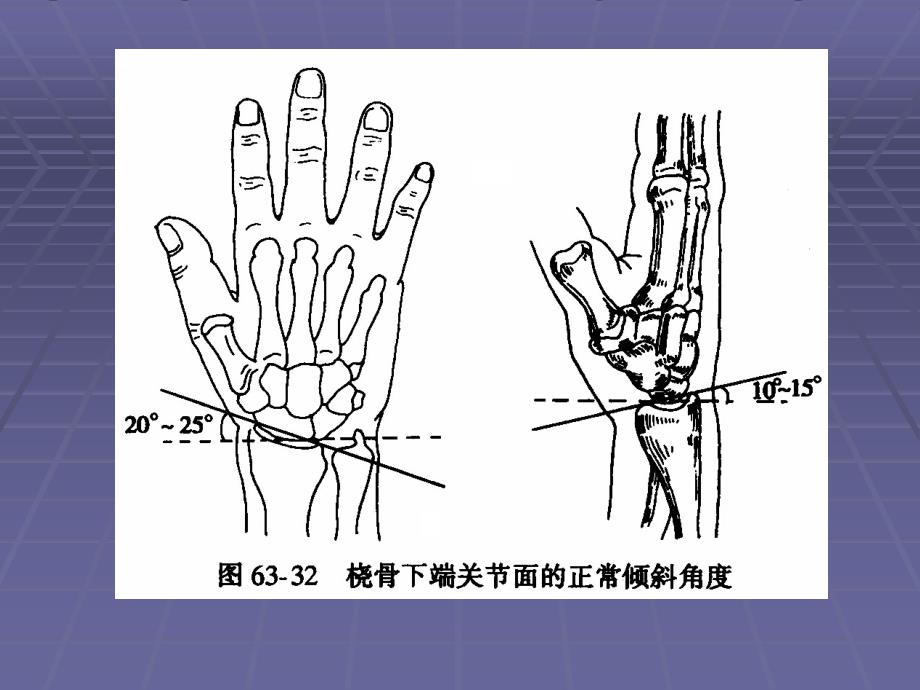 最新桡骨远端骨折.PPT文档_第4页