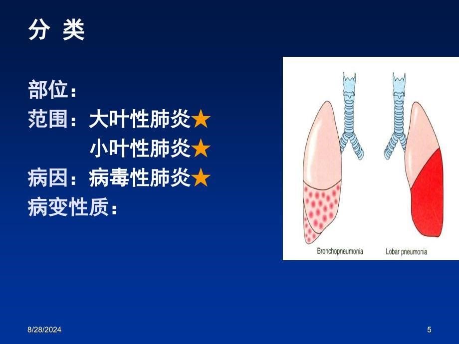 病理学：肺炎_第5页