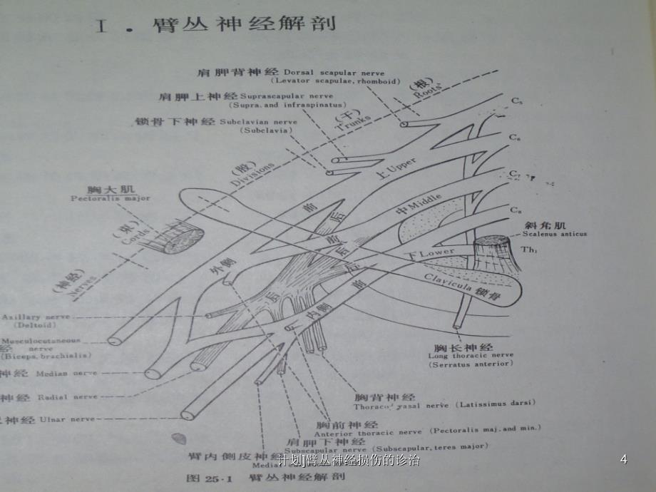 计划臂丛神经损伤的诊治课件_第4页