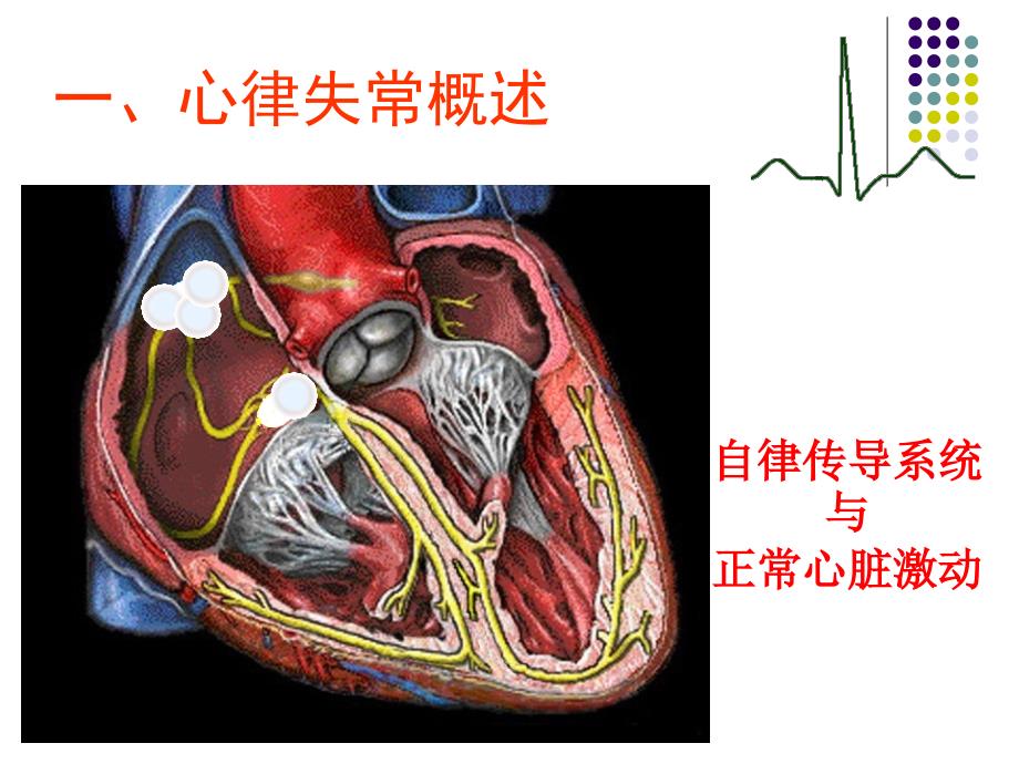 心律失常基本判读步骤_第4页