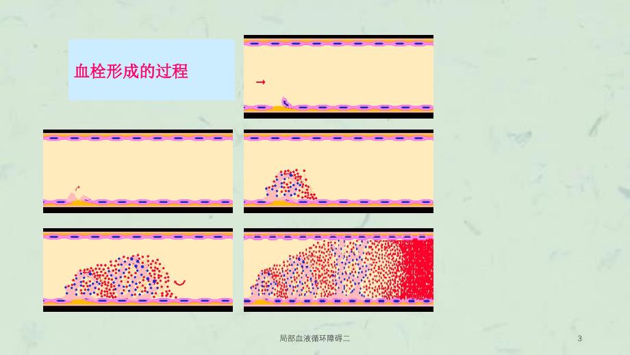 局部血液循环障碍二课件_第3页