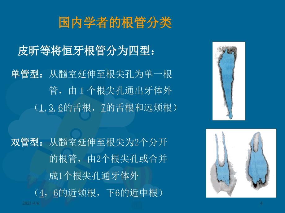 牙髓腔解剖文档资料_第4页