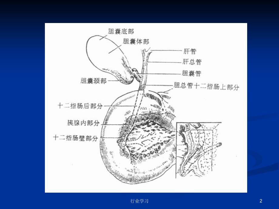 胆石症cholelithiasis含治疗术后饮食特制研究_第2页