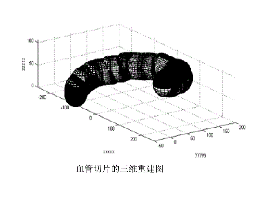 医学专题：血管切片的三维重建_第4页